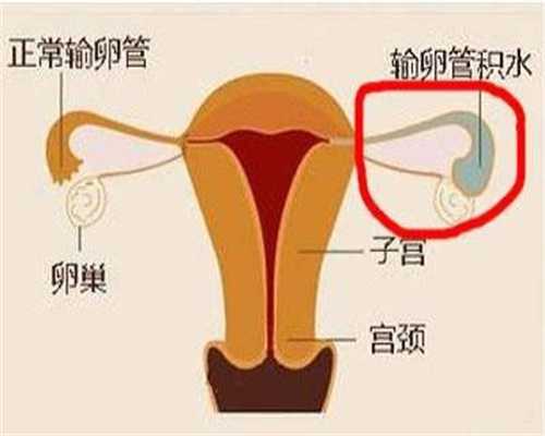 上海代孕包成功价格表_孕妇肚皮长红点痒