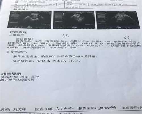 上海代孕公司费用_产前排畸检查有哪些