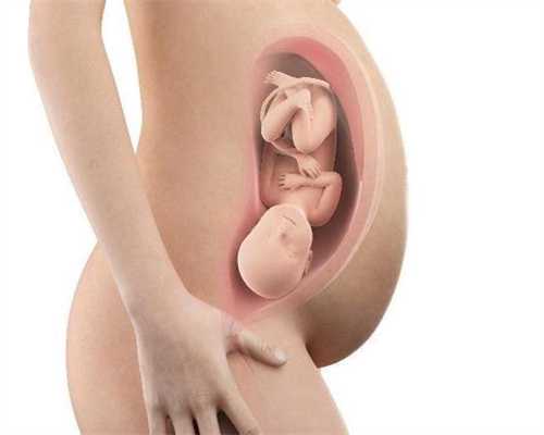 上海代孕双胞胎_hcg值一万多是宫外孕吗
