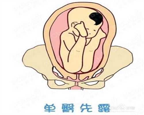 上海代孕中心需要多少钱_孕早期胚胎不好的表现