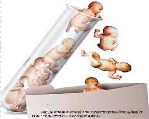 助孕在哪里_剖腹产三胎是常见的例子吗