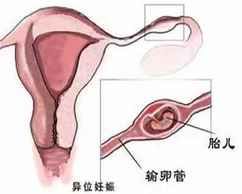 上海代孕中心-专业找上海代孕价格-上海三代试管代孕价格