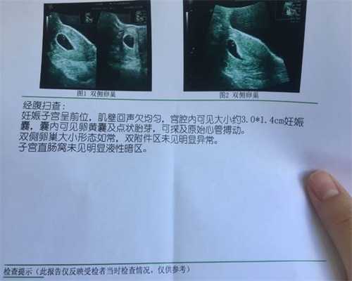 上海供卵代孕_上海代孕条件_上海代孕价格哪家便宜