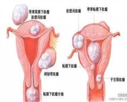 子宫内膜多厚适合胚胎移植