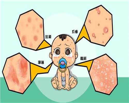 广州做试管婴儿多少钱