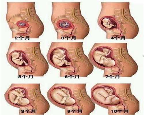 试管婴儿顺产时候应该面临的措施是什么？