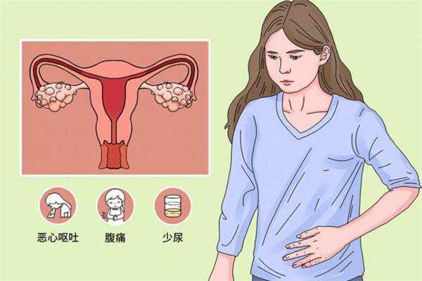 教女性取卵后判断腹水2种方法，除症状外竟然还有它